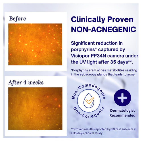 JASH'IN'CAYR Acne Control Moisturiser for Blemish Relief & Pore Control